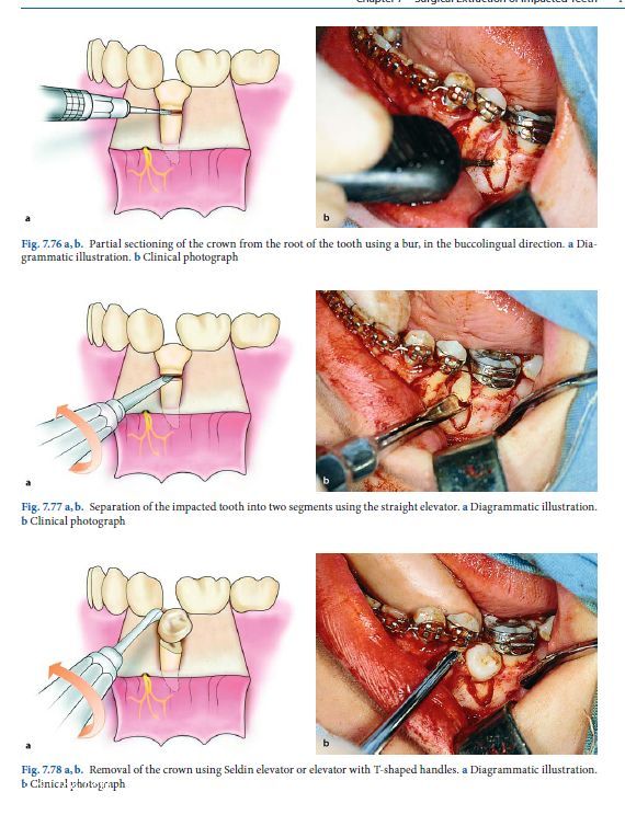 口腔外科常见的手术  经典  特实用 - 淄博张店牙科---牙艺人生 - 淄博牙医 张店牙科