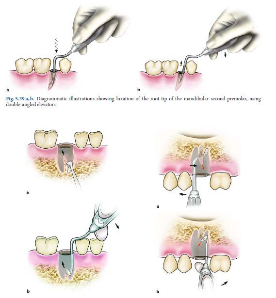 口腔外科常见的手术  经典  特实用 - 淄博张店牙科---牙艺人生 - 淄博牙医 张店牙科